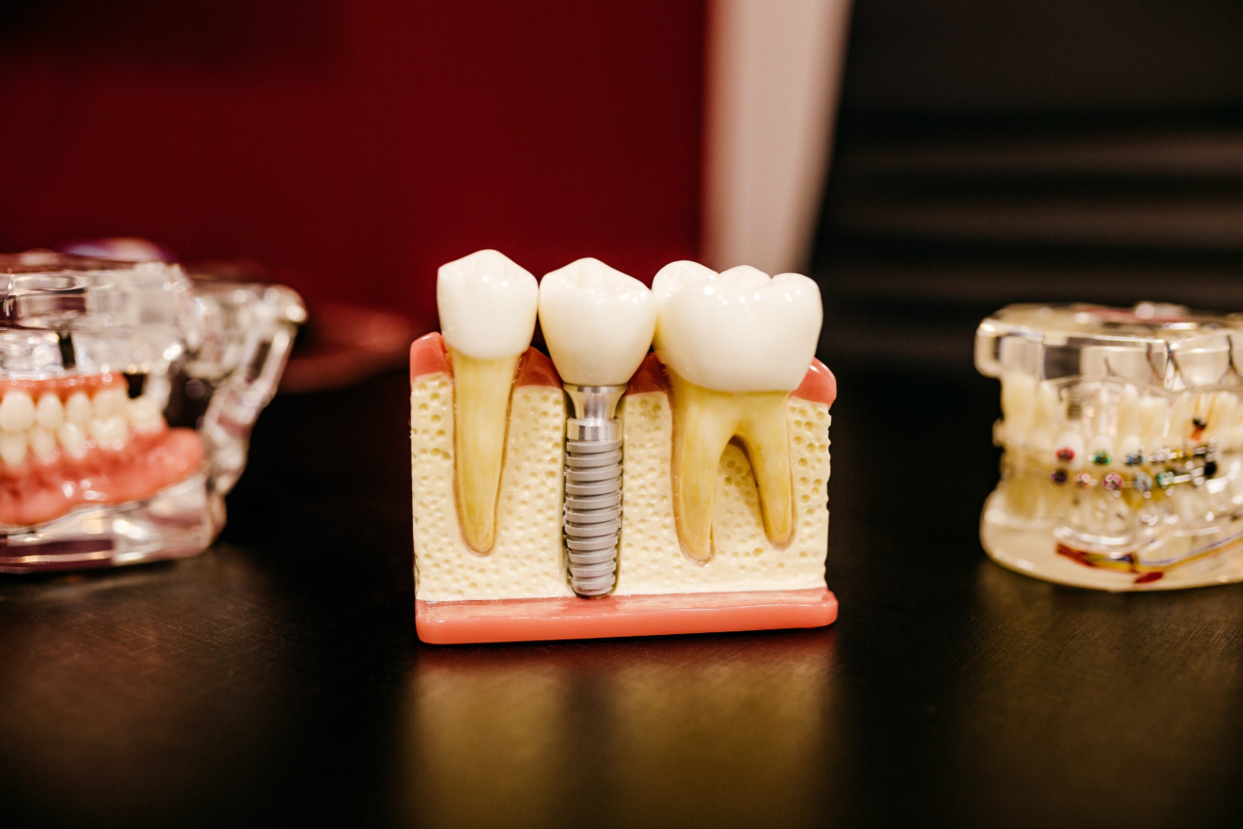 Dentures